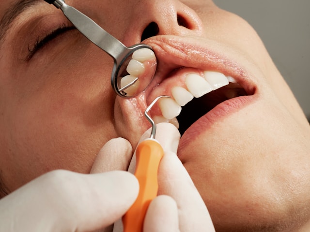 Full Mouth Reconstruction (FMR)